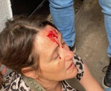 Ataque en una escuela de La Plata: un exalumno ingresó con un palo, golpeó a estudiantes e hirió a una preceptora