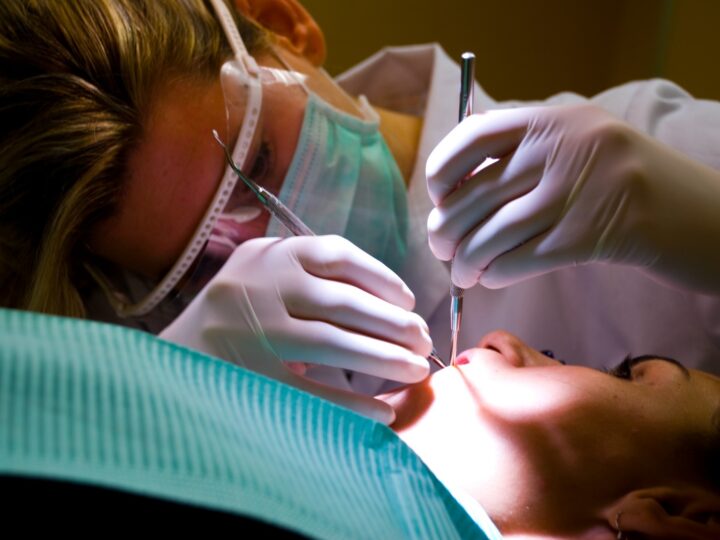 ¿Chau implantes dentales?